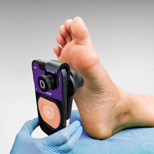 Dermlite - DL1